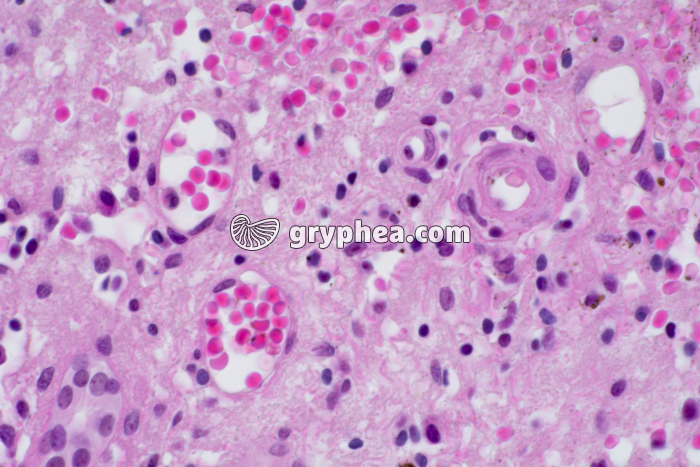 Foie Homme capillaires sanguins x200 - gryphea.org